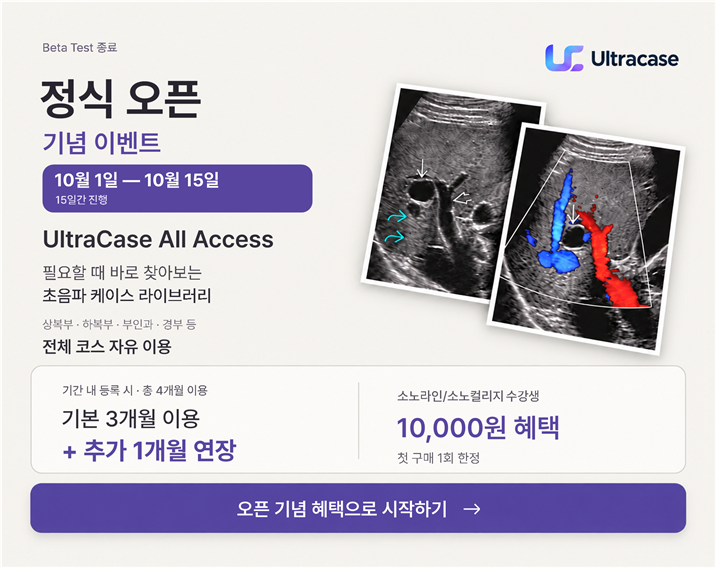 Ultracase 정식 오픈 기념 이벤트